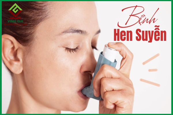 Hen suyễn và những điều cần biết để điều trị hiệu quả