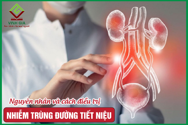 Tổng hợp thông tin cần biết về nhiễm trùng đường tiết niệu