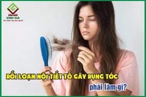 Rối loạn nội tiết tố gây rụng tóc: Nguyên nhân và cách điều trị