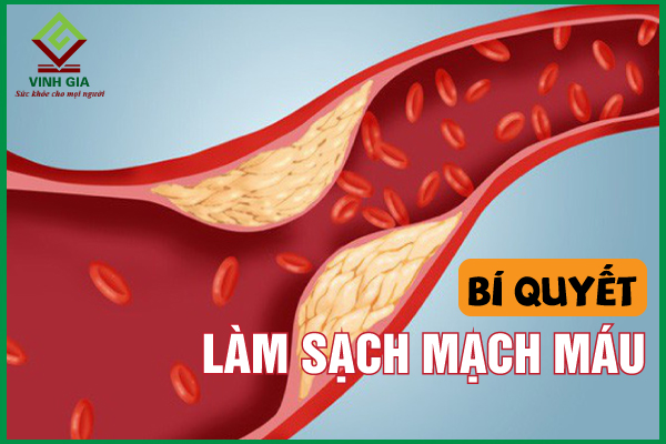 Làm sạch mạch máu giúp cơ thể khỏe mạnh và phòng bệnh nhờ bí quyết đơn giản