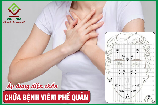 Cách chữa viêm phế quản bằng diện chẩn hiệu quả