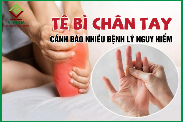 Tê bì chân tay – Dấu hiệu cảnh báo gì?