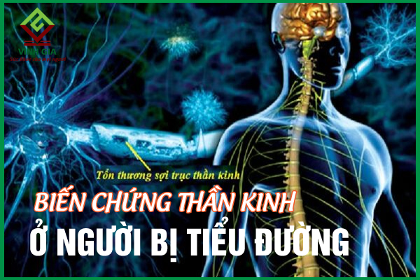 Tìm hiểu những biến chứng thần kinh ở bệnh tiểu đường