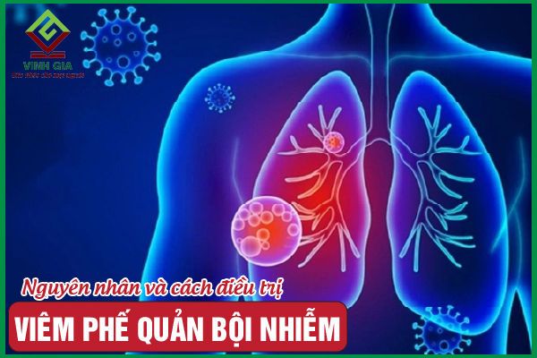 Viêm phế quản bội nhiễm: Nguyên nhân, dấu hiệu và điều trị