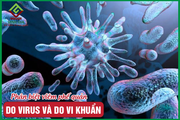 Viêm phế quản do virus khác gì viêm phế quản do vi khuẩn?