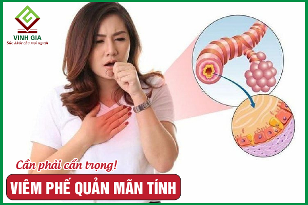 Viêm phế quản mãn tính: Nguyên nhân, dấu hiệu và điều trị