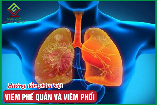 3 yếu tố giúp phân biệt bệnh viêm phổi và viêm phế quản