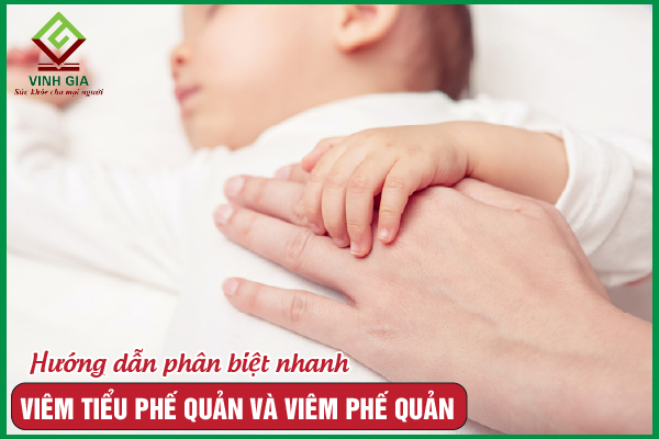 Viêm tiểu phế quản và viêm phế quản khác nhau thế nào?