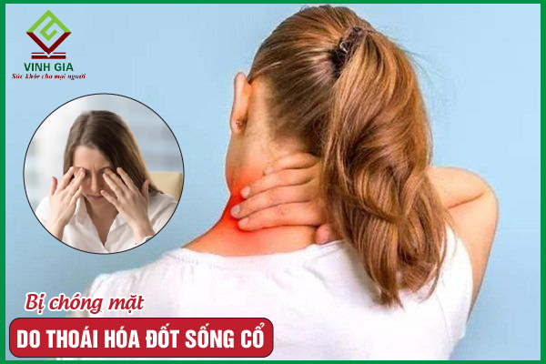 Thoái hóa đốt sống cổ gây chóng mặt: Nguyên nhân và khắc phục