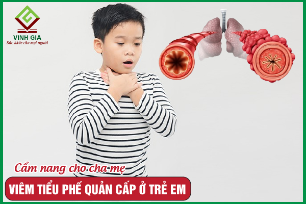 Viêm tiểu phế quản cấp ở trẻ em: Nguyên nhân và điều trị