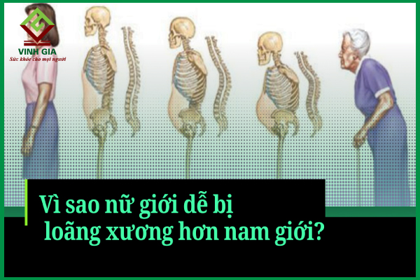5 nguyên nhân nữ giới có nguy cơ loãng xương hơn nam giới