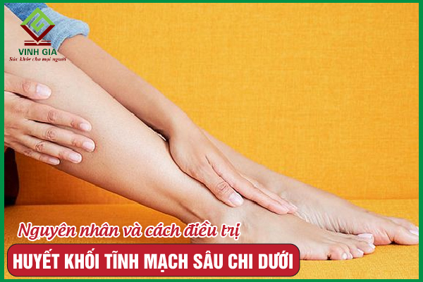 Huyết khối tĩnh mạch sâu chi dưới: Nguyên nhân và giải pháp