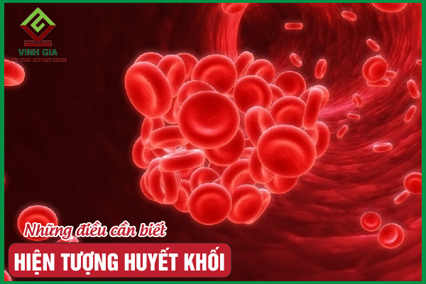 Huyết khối: Nguyên nhân, triệu chứng, chẩn đoán và giải pháp