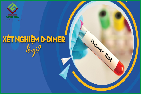 Xét nghiệm huyết khối D – dimer là gì và cách đọc kết quả