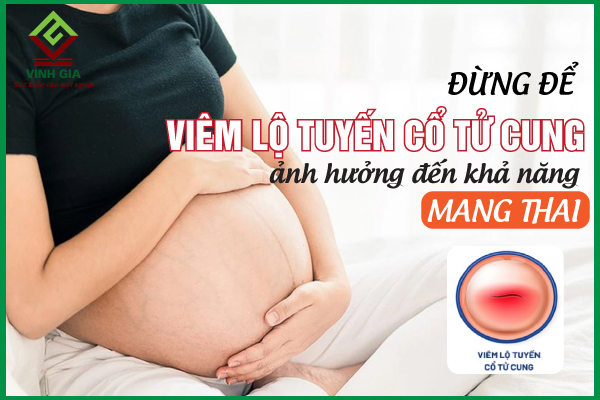 Đừng để viêm lộ tuyến cổ tử cung ảnh hưởng đến việc mang thai của bạn
