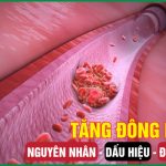 Tăng đông máu: Nguyên nhân, dấu hiệu và cách cải thiện