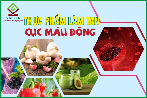 Thực phẩm làm tan cục máu đông – cách ngăn đột quỵ tự nhiên