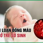 Rối loạn đông máu ở trẻ sơ sinh: Tìm hiểu để khắc phục đúng cách