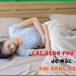 Những bệnh phụ khoa dễ “ghé thăm” chị em vào mùa hè