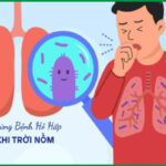 Trời nồm đóng kín cửa cả ngày: Thói quen tưởng sạch mà hại phổi